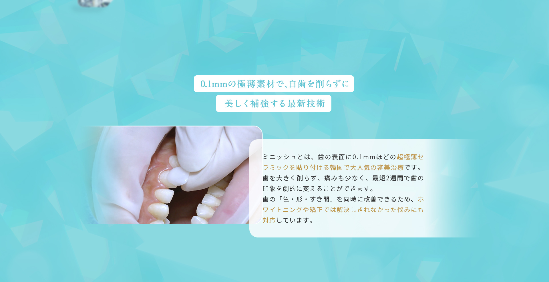 ミニッシュとは